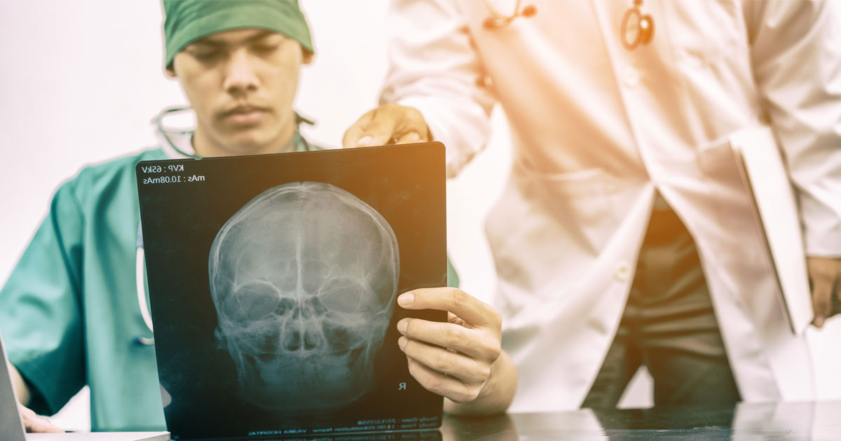 What Are the Long-Term Effects of a Car Accident-Related Brain Injury?